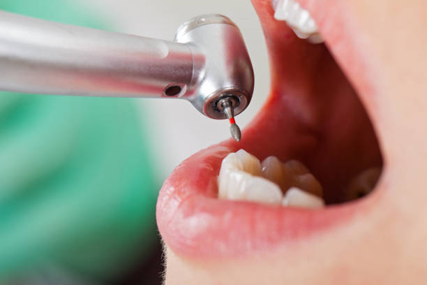Best 24-Hour Emergency Dentist in Blue Ridge, VA